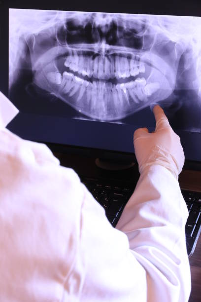 Best Emergency Gum Treatment in Sweetwater, FL